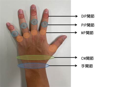 手指第一節|「指の第一関節が痛い」原因とは？何科を受診するべきかも併せ。